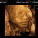 Marcus Norman Photo 18