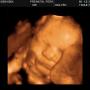 Alicia Foster Photo 19