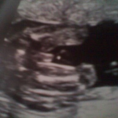 Josh Richardson Photo 27