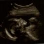 Jody Rose Photo 22