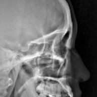 Ronghui Zhou Photo 5