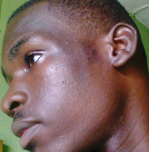 Emmanuel Moses Photo 18 Emmanuel Moses Photo 18