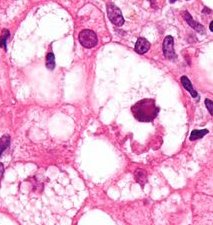 Jeffrey Kaplan Photo 47