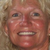 Shelley Gette Photo 4