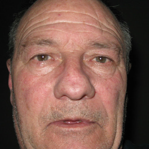 Harold Dixon Photo 19