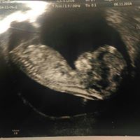 Stephanie Norwood Photo 37