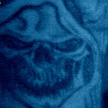 Larry Hebert Photo 10