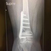 Rachelle Duncan Photo 26