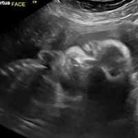 Tina Dillon Photo 15