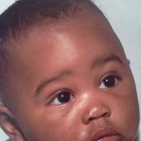 Willie Austin Photo 12