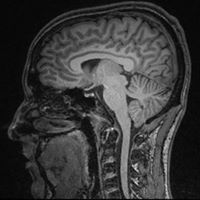 Allen Mcconnell Photo 12