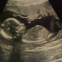 Bridget Watkins Photo 31