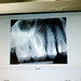 Ray Root Photo 17