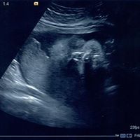 Jessie Billingsley Photo 3