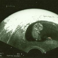 Renee Marquardt Photo 12