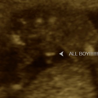 Sam Waldron Photo 17