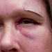 Ann Hurt Photo 31