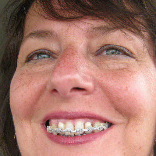 Linda Spencer Photo 16