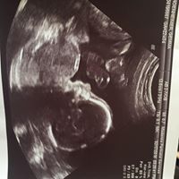 Chris Fallon Photo 30