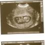 Kimberly Casey Photo 4