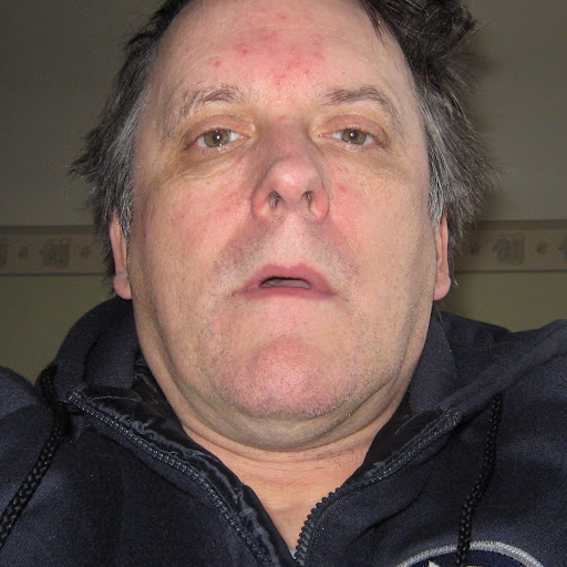 James Collette Photo 5