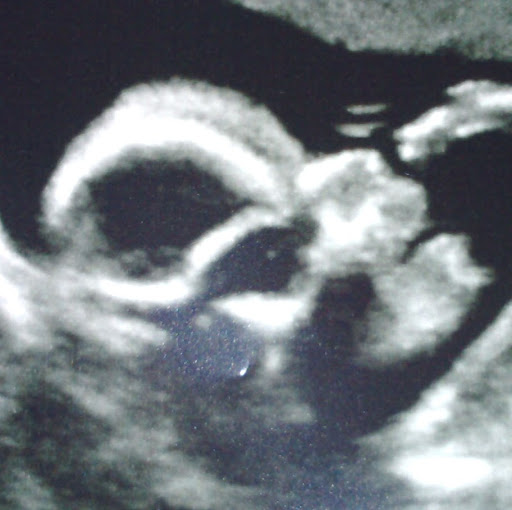 Jenny Hunter Photo 32