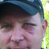 Frank Simmons Photo 31