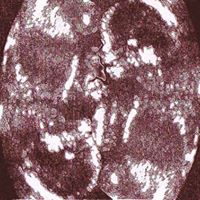 Justin Joseph Photo 36