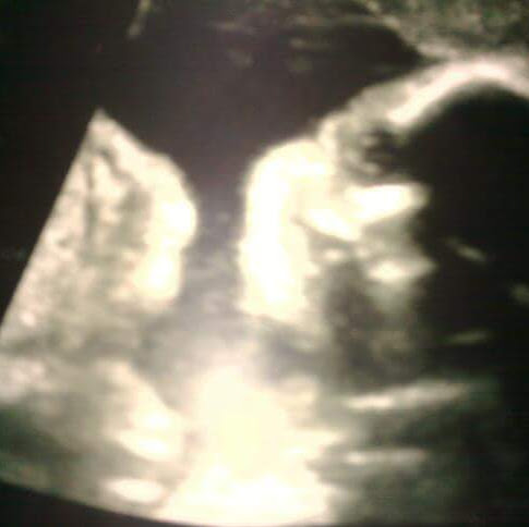 Beatrice Rodriguez Photo 13