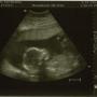 Kathleen Bergeron Photo 39