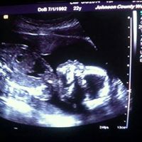 Amy Kelso Photo 25