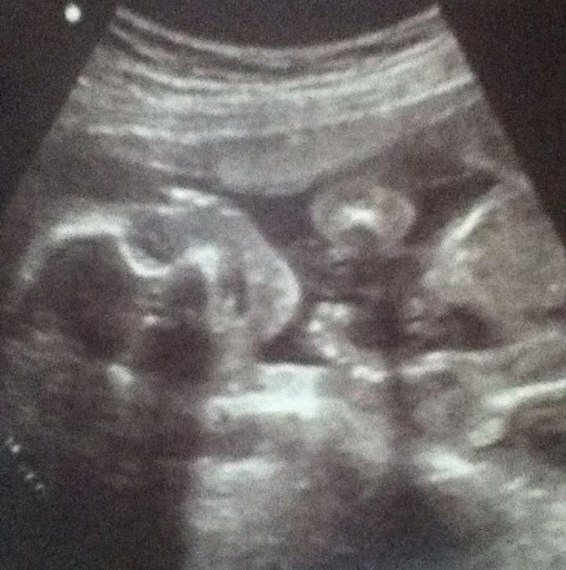 Jessica Lane Photo 11