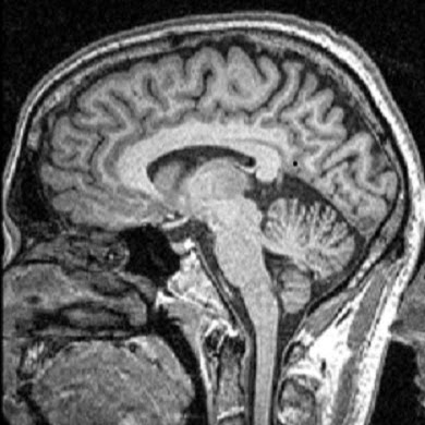 Daniel Fallon Photo 9