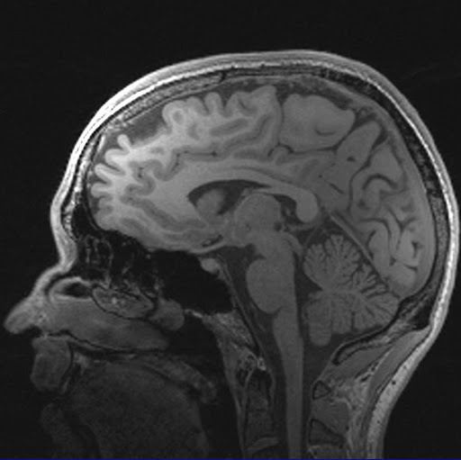 David Weissman Photo 13 David Weissman Photo 13